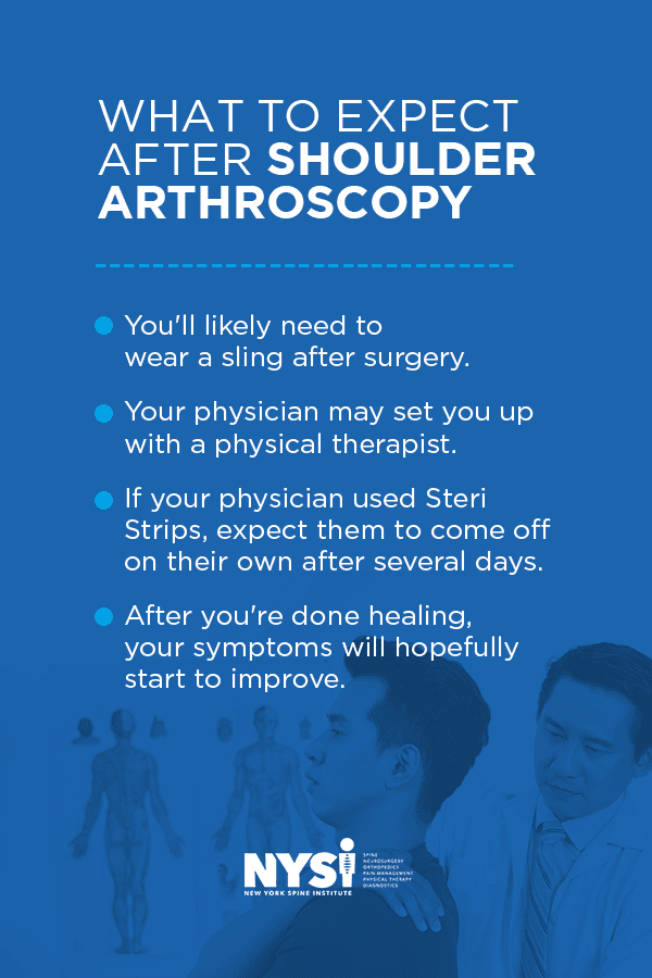 Everything to know about shoulder arthroscopy