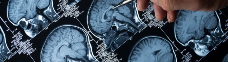 What are pediatric brain tumors