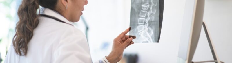 What is a spinal fracture
