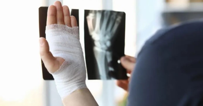 Zoomed in image of man with wrapped hand while looking at x-rays