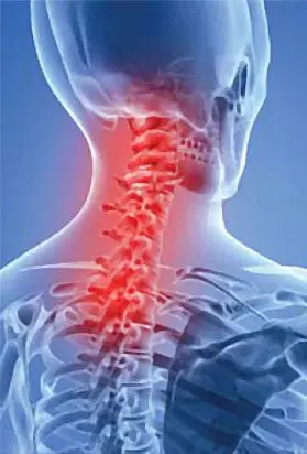 Animated skeletal image highlighting the upper spine and neck region