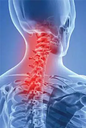 Imagem animada do esqueleto destacando a coluna vertebral superior e a região do pescoço