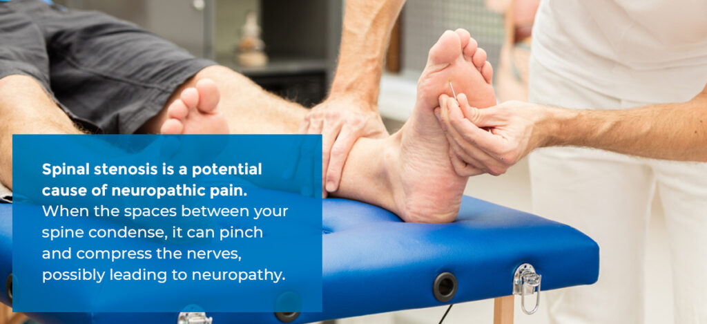 A doctor checks for neuropathy in a patient 
