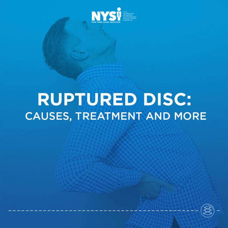 Ruptured disc causes and treatments