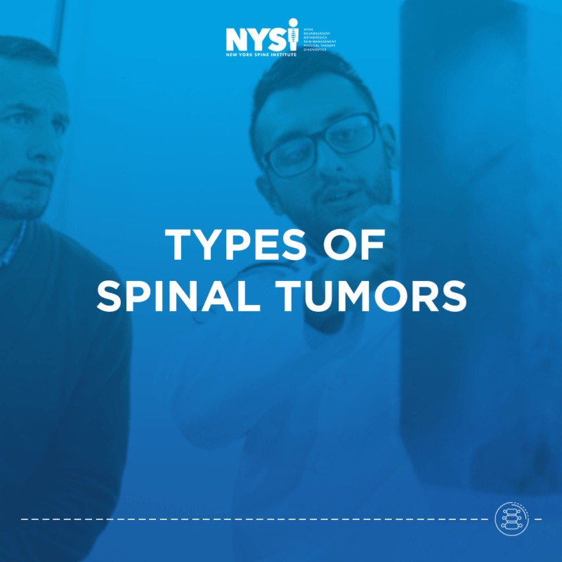 Types of Spinal Tumors