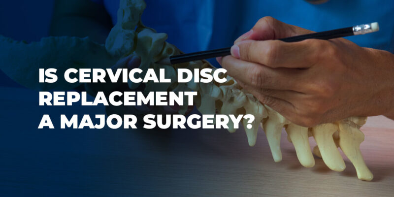 ¿Es la sustitución discal cervical una cirugía mayor?